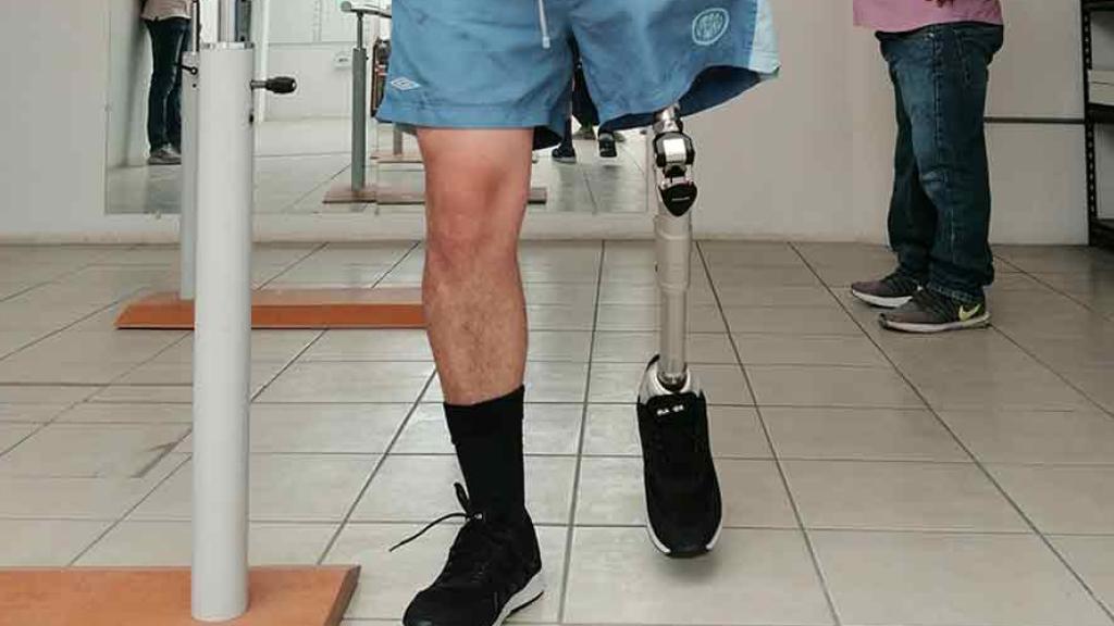 THIS IS HOW AN ENTREPRENEURSHIP INCUBATED AT TEC GDL HELP PEOPLE WITH AMPUTATIONS